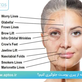 چگونه از پیری پوست جلوگیری کنیم؟