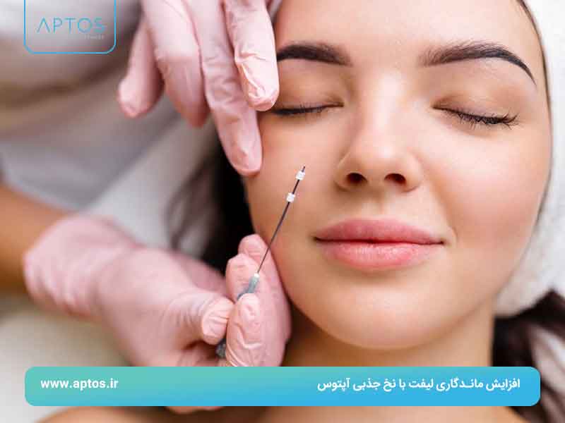 افزایش ماندگاری لیفت با نخ جذبی آپتوس