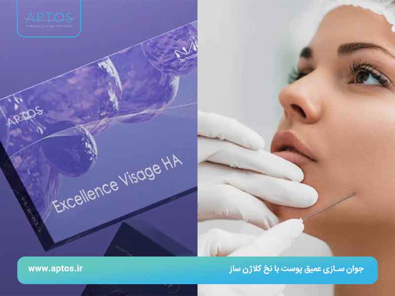 جوان سازی عمیق پوست با نخ کلاژن ساز