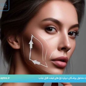 سوالات متداول پزشکان درباره نخ های لیفت قابل جذب