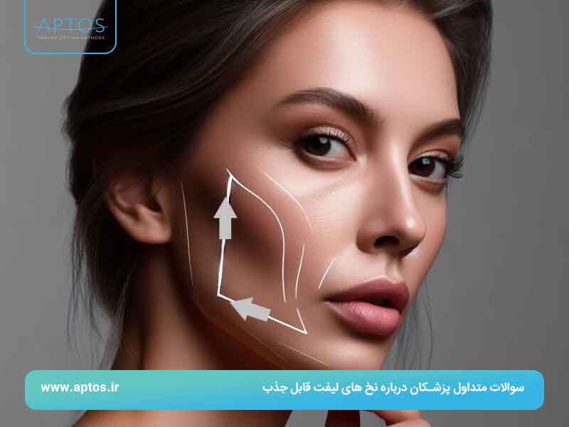 سوالات متداول پزشکان درباره نخ های لیفت قابل جذب