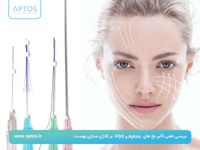 بررسی علمی تأثیر نخ های PDO و Aptos بر کلاژن سازی پوست