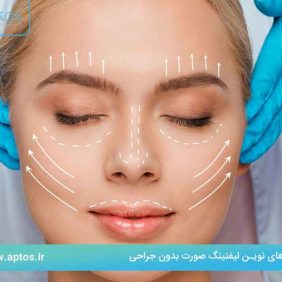 روش‌های نوین لیفتینگ صورت بدون جراحی