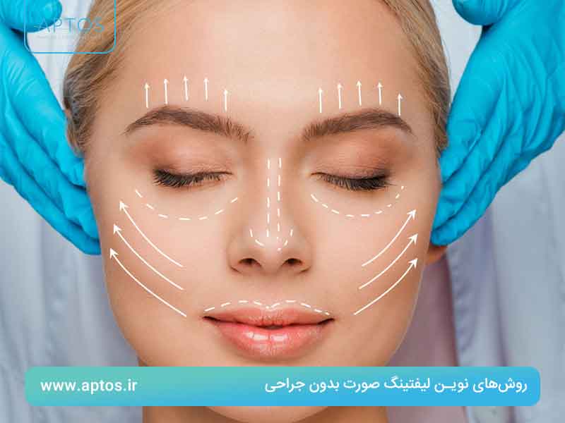 روش‌های نوین لیفتینگ صورت بدون جراحی