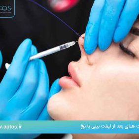 مراقبت های بعد از لیفت بینی با نخ 
