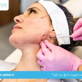 آیا لیفت صورت با نخ درد دارد؟ | درد بعد از لیفت با نخ چقدر است؟