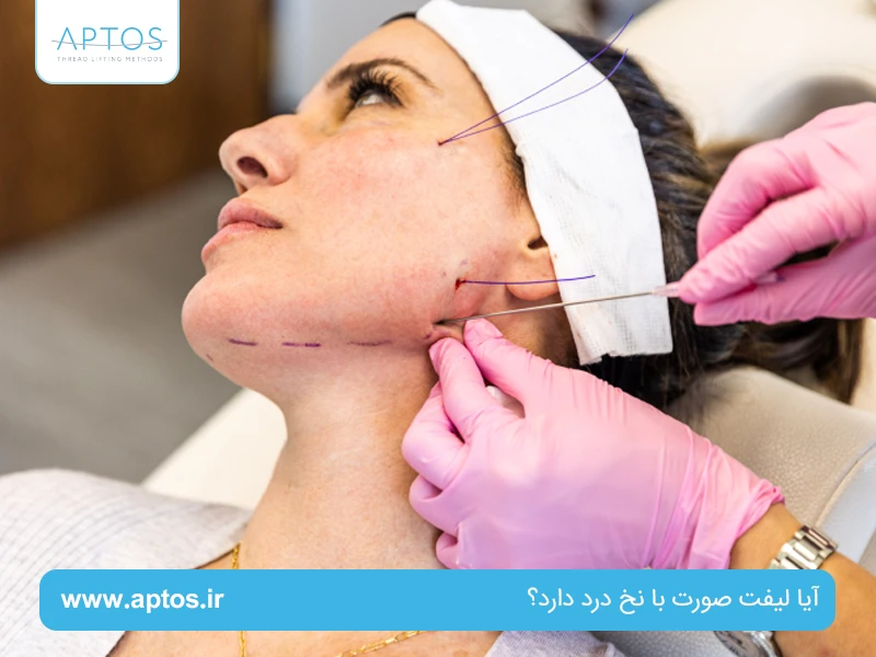 آیا لیفت صورت با نخ درد دارد؟ | درد بعد از لیفت با نخ چقدر است؟