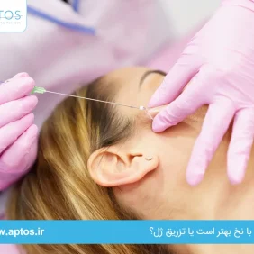 لیفت با نخ بهتر است یا تزریق ژل؟