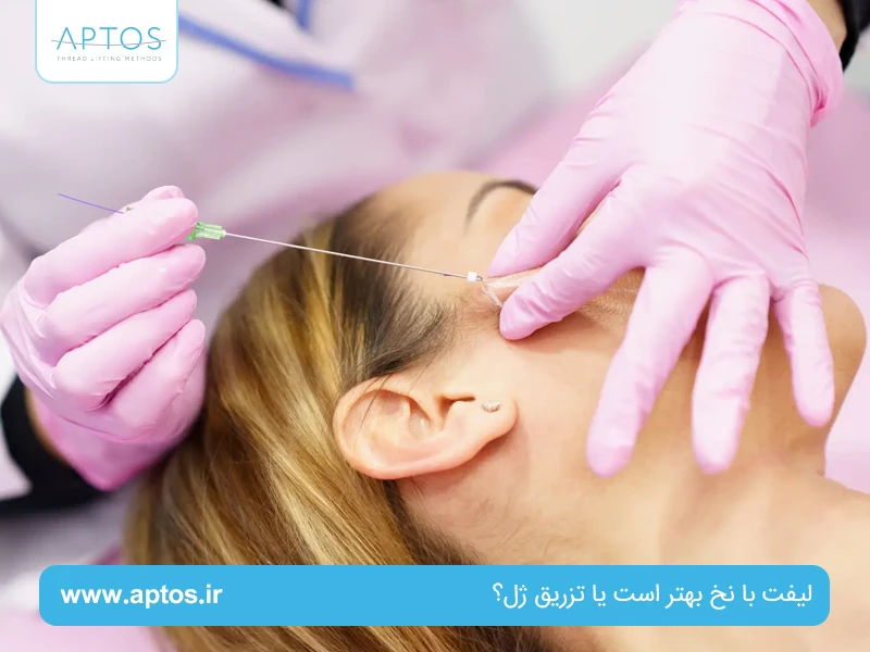 لیفت با نخ بهتر است یا تزریق ژل؟