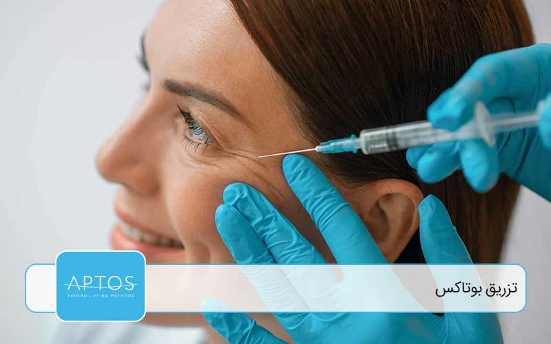 تزریق بوتاکس (Botulinum Toxin Type A)