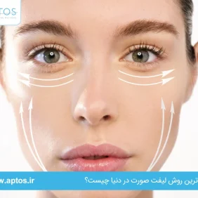 جدیدترین روش لیفت صورت در دنیا چیست؟