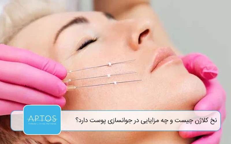 نخ کلاژن چیست و چه مزایایی در جوانسازی پوست دارد؟