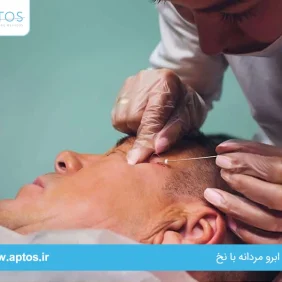  لیفت ابرو مردانه با نخ