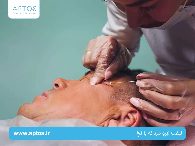  لیفت ابرو مردانه با نخ