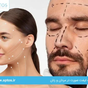 تفاوت لیفت صورت در مردان و زنان