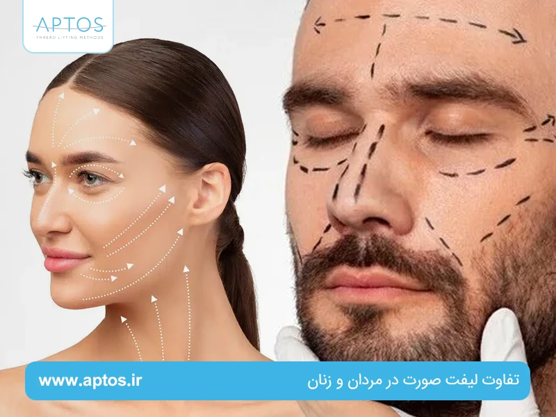 تفاوت لیفت صورت در مردان و زنان